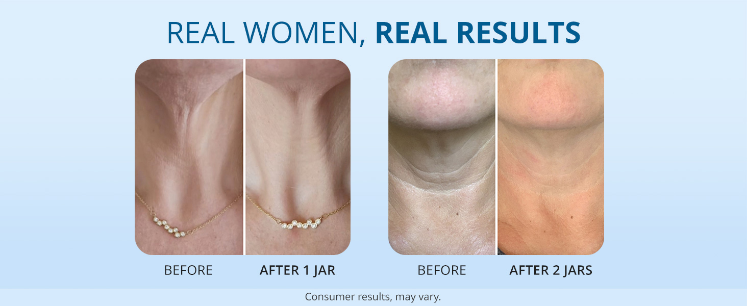 goPure Tighten & Lift Neck & Chest Moisturizer Cream for Visibly Firming, Tightening and Lifting Wrinkles & Crepey Skin, 1.7oz