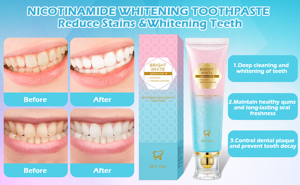 Niacinamide Whitening Toothpaste, Niacinamide Toothpaste Intensive Whitens Teeth, Protects Enamel, Removes Stains & Refreshes Breath, Daily Oral Care at Home Mint Flavor (1)